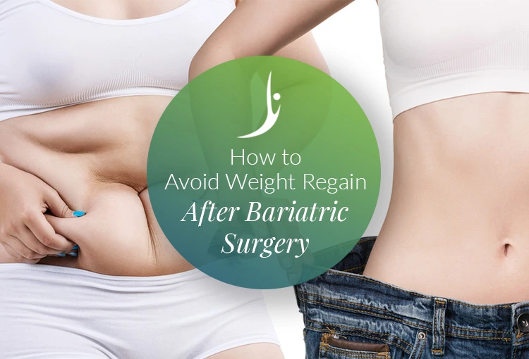 How to avoid weight gain after bariatric surgery